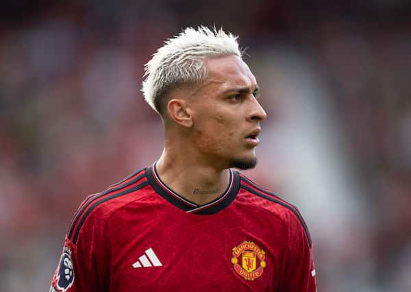 Manchester Unitedilla laituriongelma - valmis epätoivoiseen ratkaisuun Manchester Unitedilla laituriongelma – valmis epätoivoiseen ratkaisuun